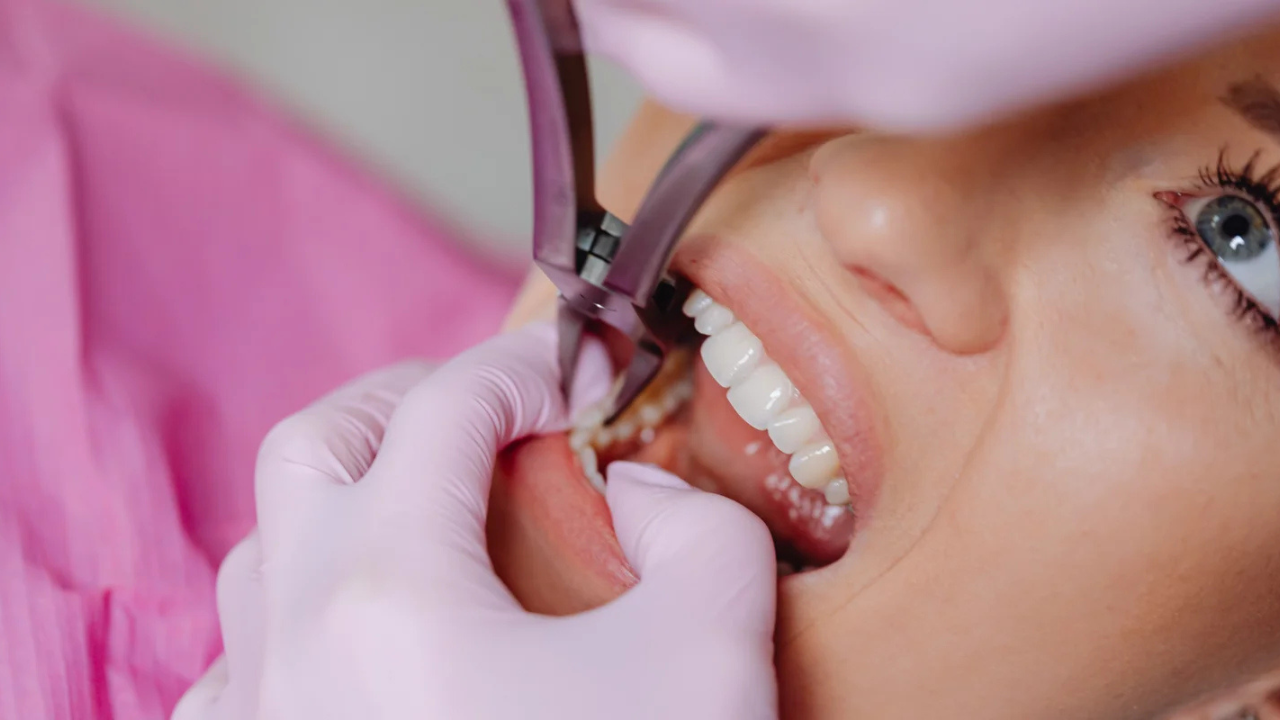 What is a Subperiosteal Implant?